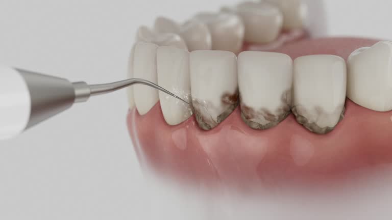 Trusted Teeth Whitening service in Kincheloe, MI - Dentist Open Now